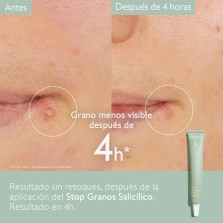 CAUDALIE VINOPURE STOP GRANOS SALICÍLICO 15 ML